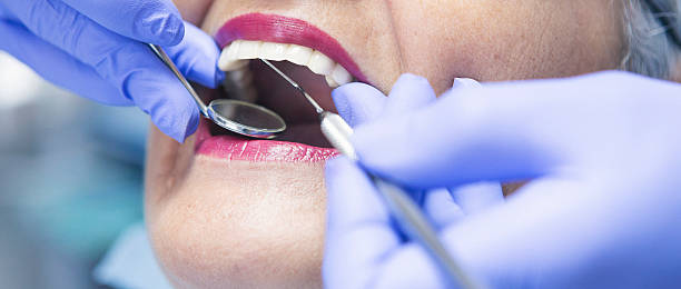 Best Emergency Tooth Extraction in Lugoff, SC